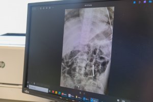 Białystok. Lekarze z UDSK apelują do rodziców o czujność